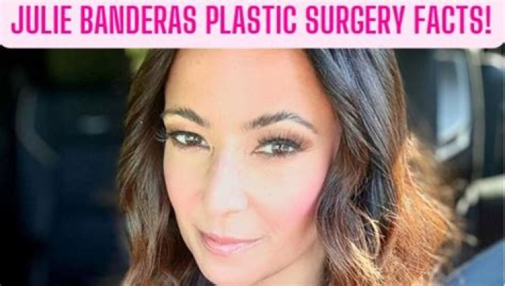 Julie Banderas Plastic Surgery: Unpacking the Public Discussion Around Appearance Changes